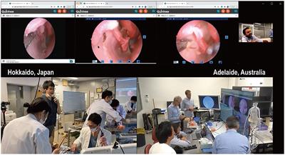 Remote Training of Functional Endoscopic Sinus Surgery With Advanced Manufactured 3D Sinus Models and a Telemedicine System